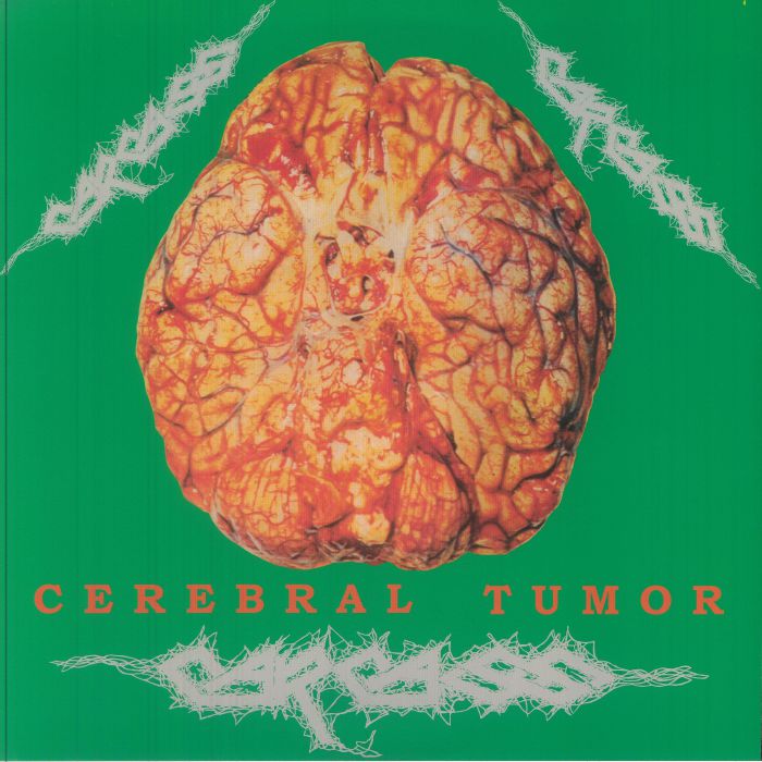 Cerebral Tumor: Brain Washing At Live Station Dortmund 30/07/90 - 2xLP vinyl record cover