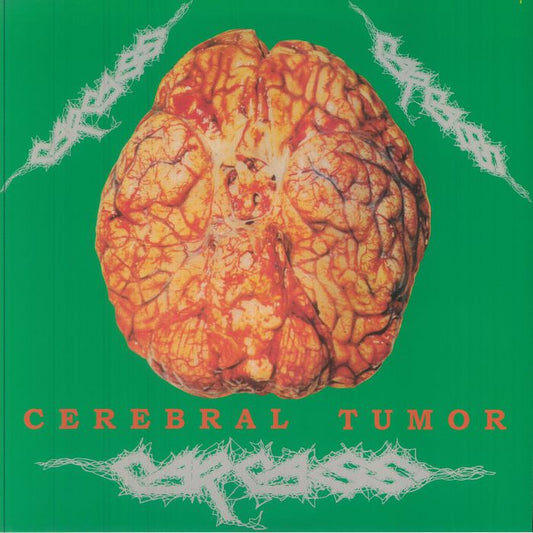 Cerebral Tumor: Brain Washing At Live Station Dortmund 30/07/90 - 2xLP vinyl record cover